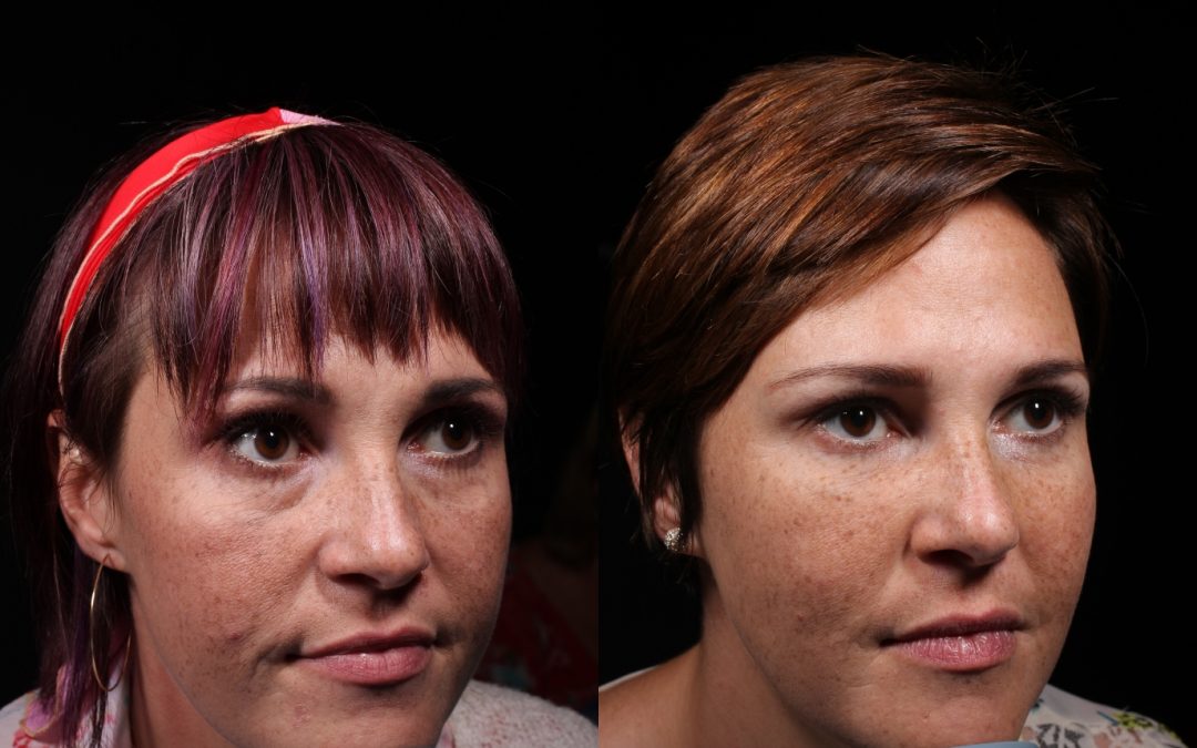 Lips / Mouth